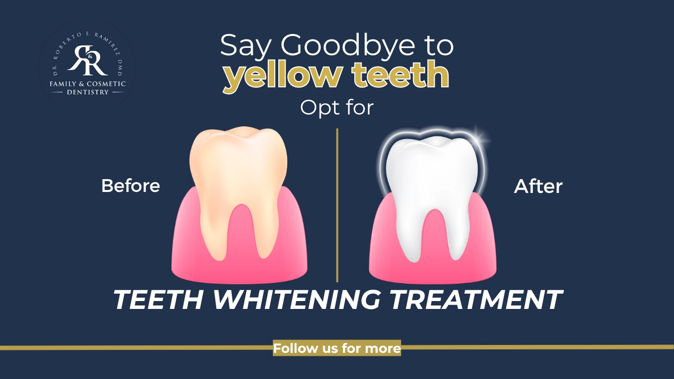 R & R Dentistry_Teeth Whitening
