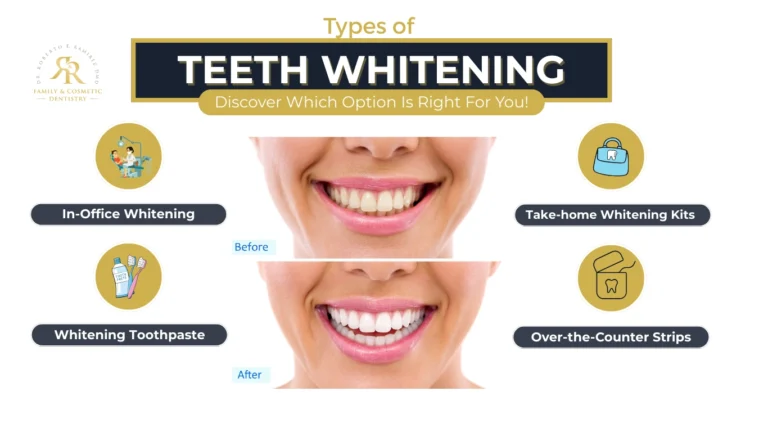 Types of teeth