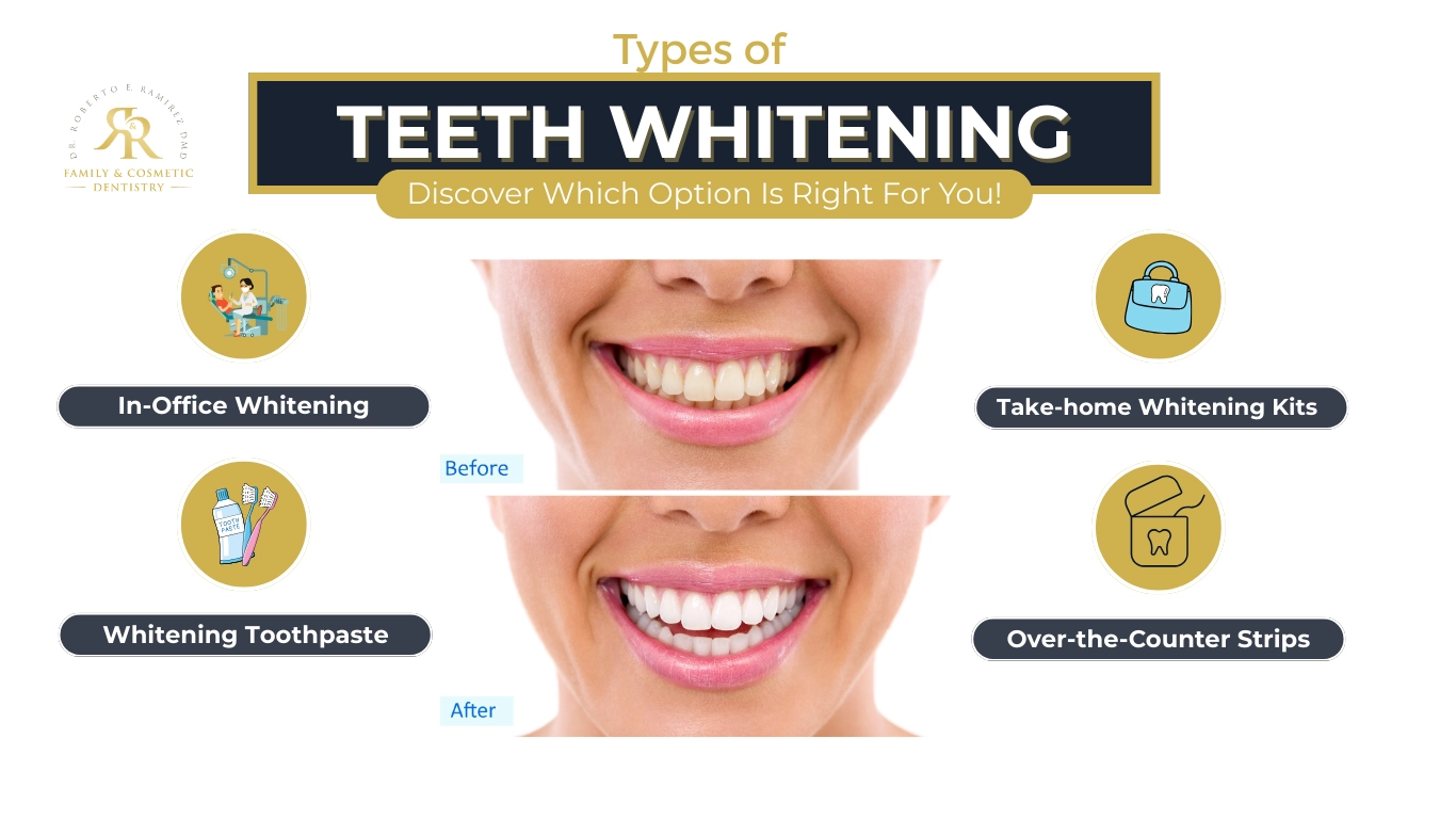 Types of teeth