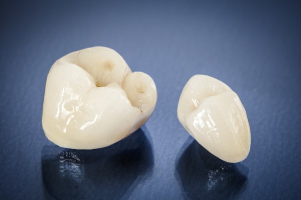 Questions To Ask About Dental Crowns