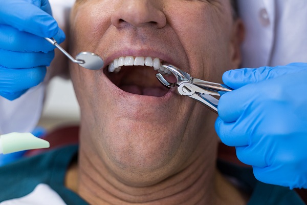 When A Tooth Extraction May Be Recommended
